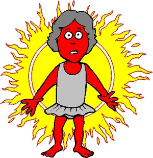 Sunburn